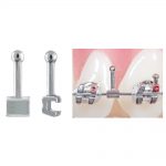 Attachments Archwire Hooks Crimpable Ball Hooks with Split Archwire Opening