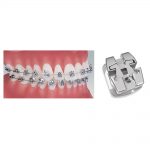 Metal Brackets Lotus Plus Self-Ligating Bracket System Lotus Plus Bracket System All RX Prescriptions