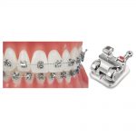 Metal Brackets Sensation M Metal SL Brackets Sensation M Roth 10 Packs
