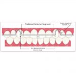550-001-TruForce-Stainless-Steel-Flat-Bow-Preformed-Retainer-Wire