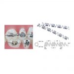 Wire Products TruFlex NiTi Springs TruFlex Nickel Titanium Distalizing Springs