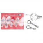 Wire Products TruFlex NiTi Springs TruFlex NiTi TaD Closed Coil Springs