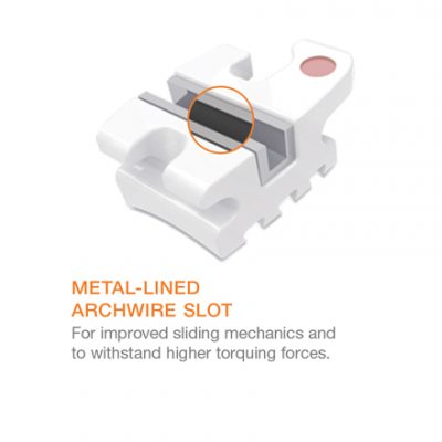 Avalon Metal-Lined Archwire Slot