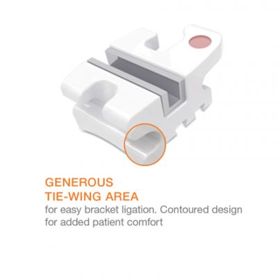 Avalon Tie Wing Area