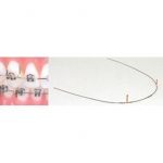 Wire Products TruForce Stainless Steel Retraction Archwires TruForce Stainless Steel Retraction Brass Post Archwire