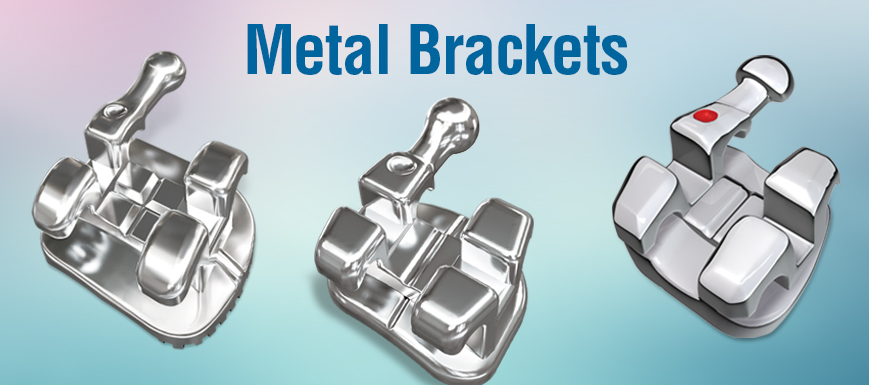 Metal Brackets