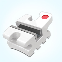 Encore-Bracket Encore! Metal-Lined Ceramic Bracket System