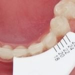 EXMD-2 Extend Measuring Device