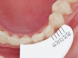 Extend Measuring Device