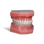 Aesthetic Brackets Sensation Active Ceramic SLB Bracket System Sensation Bracket System Typodont