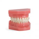 Aesthetic Brackets OrthoFlex Composite Bracket System OrthoFlex Typodonts