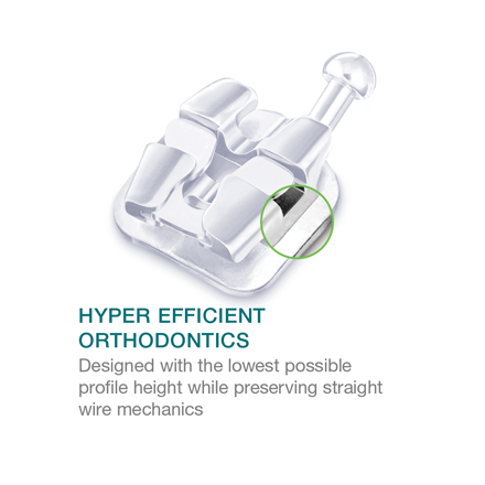 Lotus-DS-hyper-efficient