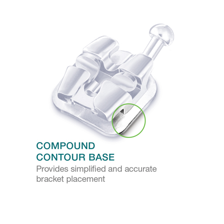 Lotus-interactive-compound-contour