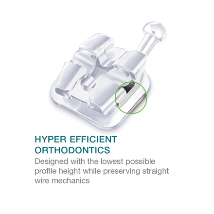 Lotus-Interactive-hyper-efficient