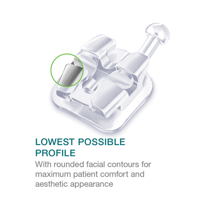 Lotus-interactive-lowest-profile