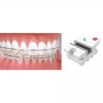 Aesthetic Brackets Encore! Metal-Lined Ceramic Bracket System Encore! Roth RX 10 Packs
