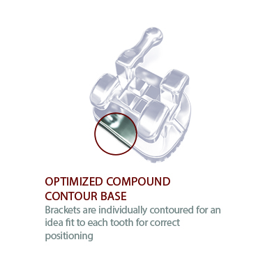 Pinnacle Slider Image3