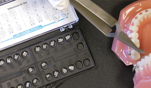 Reflections Ceramic Bracket System