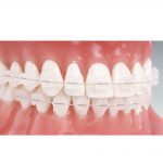 Reflections-Typodont