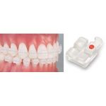 Aesthetic Brackets Pure Sapphire Bracket System Pure Brackets – 018 & 022 All RX’S