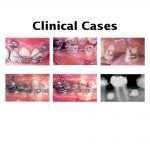 Spider Screw Case Studies