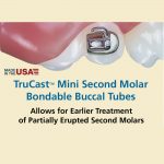TruCast Mini Bondable Buccal Tube
