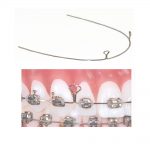 TruForce-Retraction-Archwires-2-Keyhole-Wire