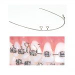 TruForce-Retraction-Archwires-4-Keyhole-Wire